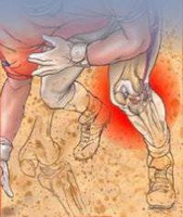 спортивные травмы коленного сустава в экстремальных видах спорта
